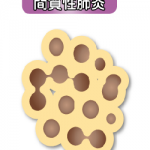 間質性肺炎に、サプリが効果あった実例、そのサプリとは?